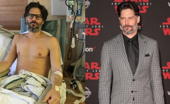 JOE MANGANIELLO REVEALS DEVASTATING HEALTH BATTLE PHOTOS
