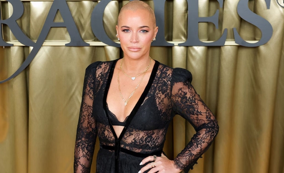 TEDDI MELLENCAMP HOSPITALIZED AFTER WAKING UP COVERED IN SORES  AMID CANCER BATTLE.